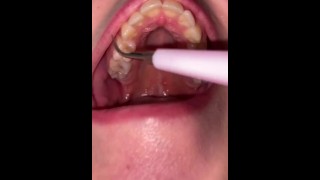 Teeth Fetish Ultrasonic Cleaning