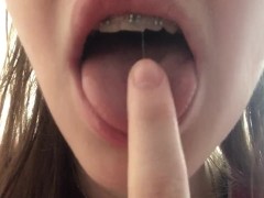 Показываю свои милые зубки в брекетах - Screenshot 10 of 16 - Tongue