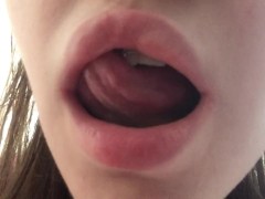 Показываю свои милые зубки в брекетах - Screenshot 2 of 16 - Defect