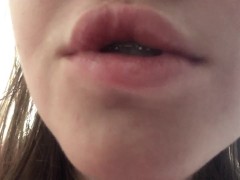 Показываю свои милые зубки в брекетах - Screenshot 3 of 16 - Cleft Lip