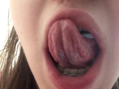 Показываю свои милые зубки в брекетах - Screenshot 4 of 16 - Braces