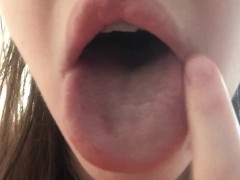 Показываю свои милые зубки в брекетах - Screenshot 8 of 16 - Cleft Lip
