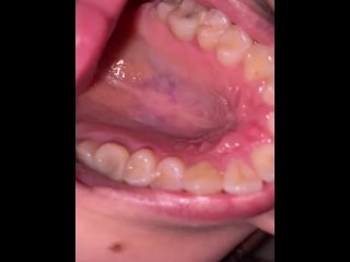 teeth, tongue, mouth tongue fetish, girl uvula
