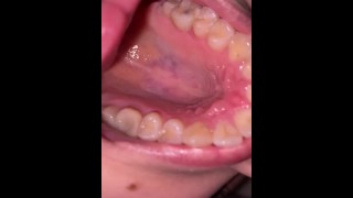 Mond tour. Uvula en tanden 