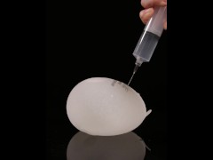 Gradual filling of expander breast implant with saline into twice its prescribed size