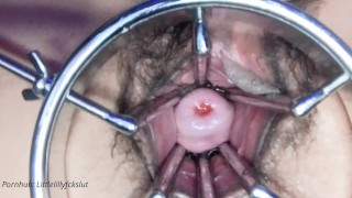 The Extremity Dildo Spreader Pussy Held Wide Open Cervix Displaying Speculum