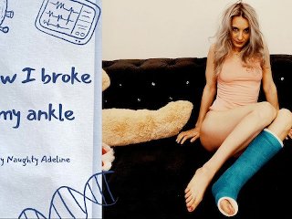 broken, leg cast fetish, broken leg cast, talking