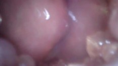 close up