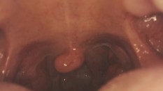 Mouth and Tongue