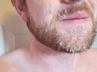 Grindr date facial aftermath!