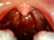 Preview 2 of My throat with endoscope