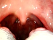 Preview 4 of My throat with endoscope