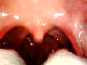 Preview 6 of My throat with endoscope