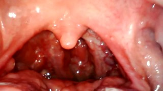 My throat with endoscope