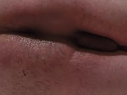 Retention Enema and Release 03