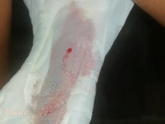 How girs using a sanitary pads during their period days - Screenshot 15 of 16 - Menstruation