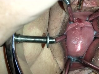 peehole, cervix, extreme close up, vagina expansion