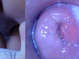 Pussy cum, Pussy cam!! (Endoscope inside creampied pussy)