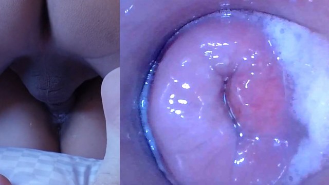 Pussy Cum, Pussy Cam!! (Endoscope inside Creampied Pussy) - Pornhub.com