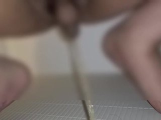 包茎がおしっこした後に皮を剥いた