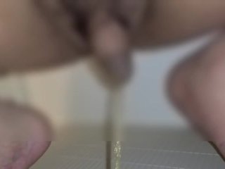 包茎がおしっこした後に皮を剥いた