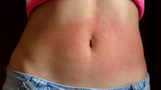 Watch Bondage Video:I show my red and bulging belly to my best friend to get excited my navel hurts from the game Paula