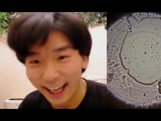 OBSERVE SPERM !!