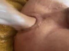Anal fisting 