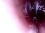 Preview 5 of BBW Milf Internal Microcamera Speculum Vaginal Dilator /voyeuroscope & Creamy Masterbation