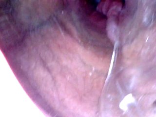 BBW Milf Internal Microcamera Speculum Vaginal Dilator /voyeuroscope & CreamyMasterbation