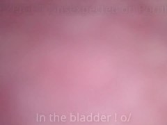 Urethra bladder insertion with diy endoscope - amateur
