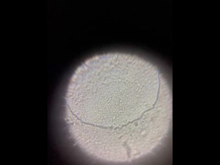Наблюдение за спермой под микроскопом (x500)!