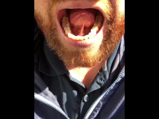 SFW Behind the Scenes look at my newly untied tongue immediately before & after surgery today