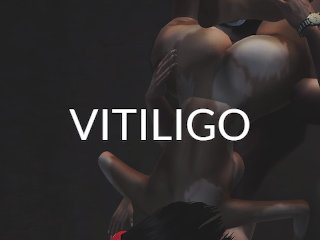 cartoon, vitiligo, big tits, ebony anal