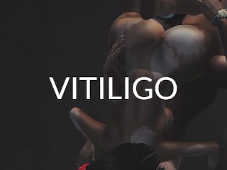 Z- Fucking a Model with Vitiligo - ROOM Sexual Storm IMVU