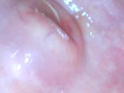 Preview 2 of Endoscope cervix exploration (Camera inside vagina)