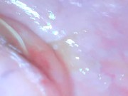Preview 6 of Endoscope cervix exploration (Camera inside vagina)