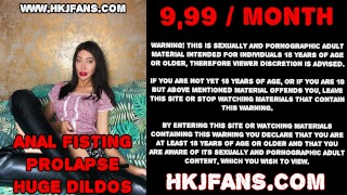 Hotkinkyjo 巨大的 XO 窥器打开到 Hotkinkjo 肛门拳交和深肛门视图的最大肛门孔 HKJFANS