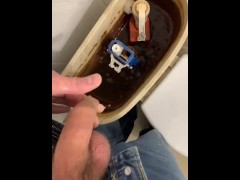 Pissing into foreskin
