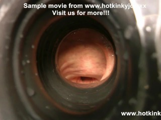 Hotkinkyjo 99cm深假阳具肛门插入，脱垂等