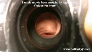 Hotkinkyjo 99cm profondo dildo penetrazione anale, prolasso e altro