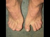 Slideshow of His Hard Working, Rough Feet (2021-09-21) In Desperate Need Of A Professional Pedicure