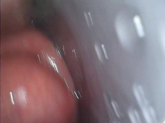 内視鏡でアナル内部　子宮口みたい - Screenshot 11 of 16 - 内視鏡