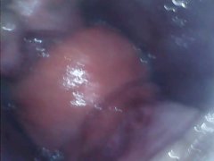 内視鏡でアナル内部　子宮口みたい - Screenshot 8 of 16 - アナル