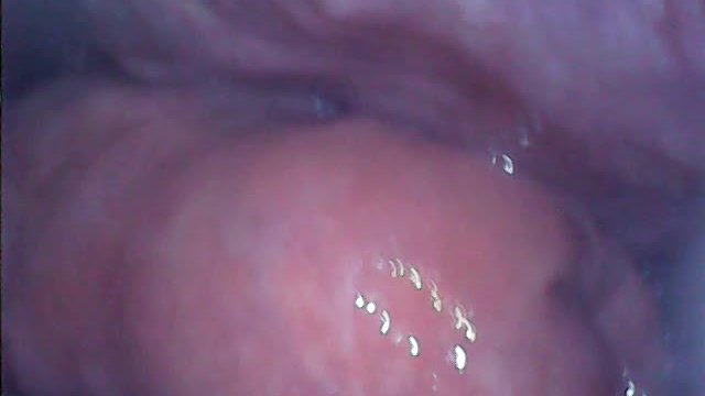 内視鏡でアナル内部　子宮口みたい - Pornhub Gay