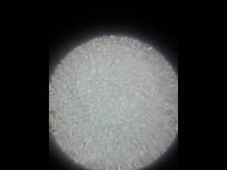 sperm cell