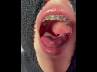uvula, tongue fetish, braces