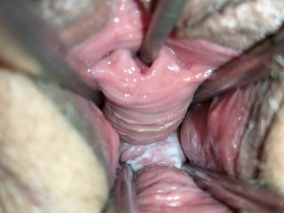 Разбрасыватель 👀 киски трахает глазок палочками для еды