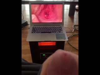 Self Ejaculation