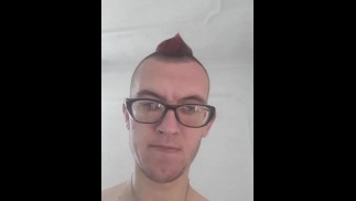 Moja guza